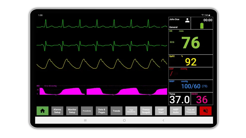 SimVS — tablet-based clinical simulation platform with patient monitor